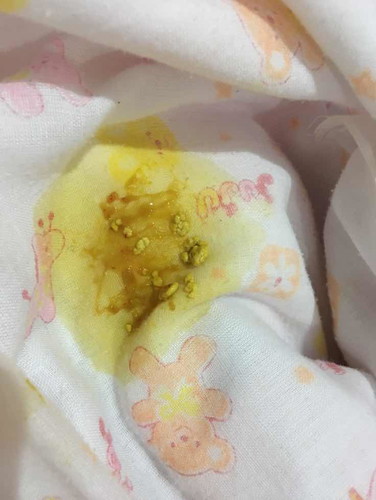 อึเด็ก!!