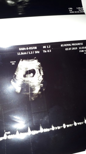 keluar flek mgkn karna stres