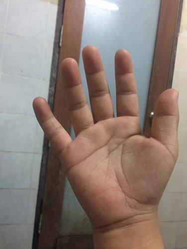 อาการใกล้คลอดหรือเปล่า?