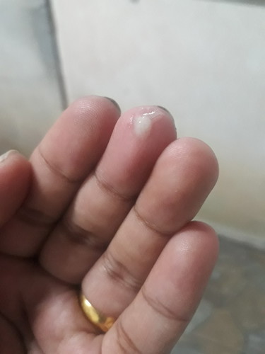 36+6w