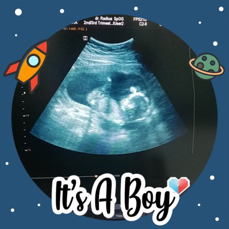 perkembangan bayi di 15 bulan