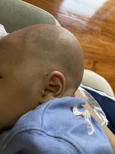 หัวน้องแบบนี้ปกติไหมคะ