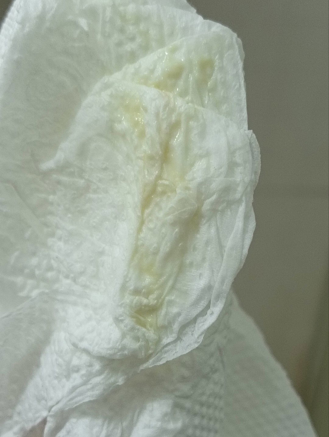 ตั้งครรภ์ 38 วีค มีมูกแบบนี้ออก