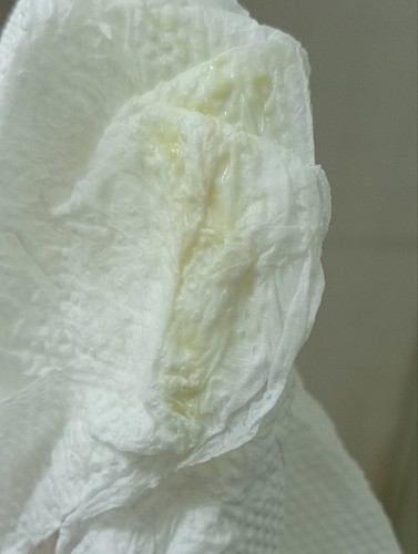 ตั้งครรภ์ 38 วีค มีมูกแบบนี้ออก