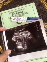 Irma Mutiah profile icon