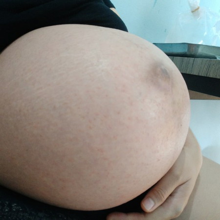 ผืนคัน
