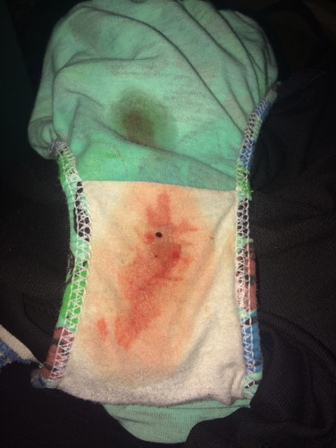 Blood
