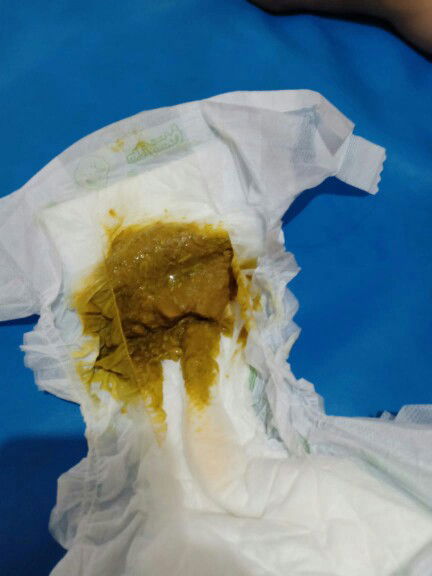 Fases bayiku aromanya seperti pete bau banget dan bau asam