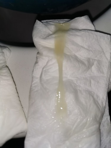 Perut Mengeras Selepas Kena Scan