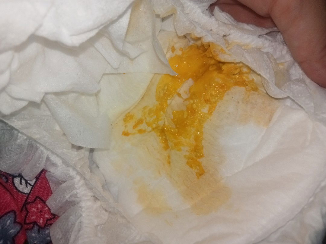 Berak bayi kuning berair