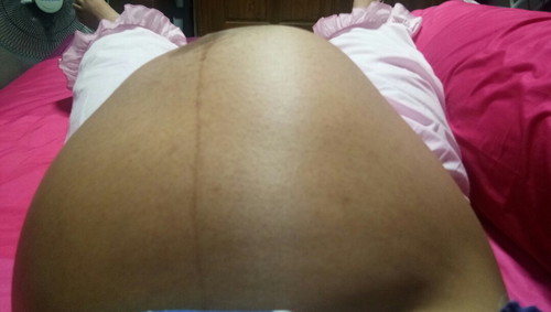 ลูกโก่งตัว