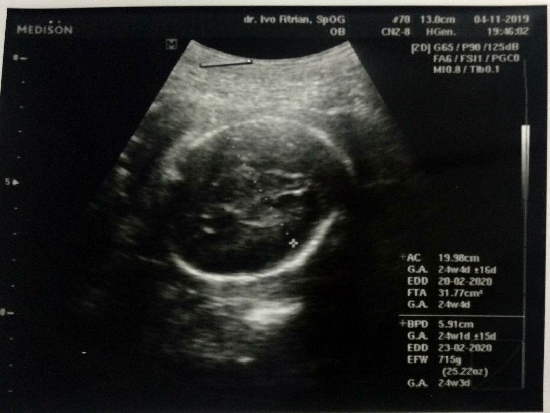 Anissah Wijaya profile icon