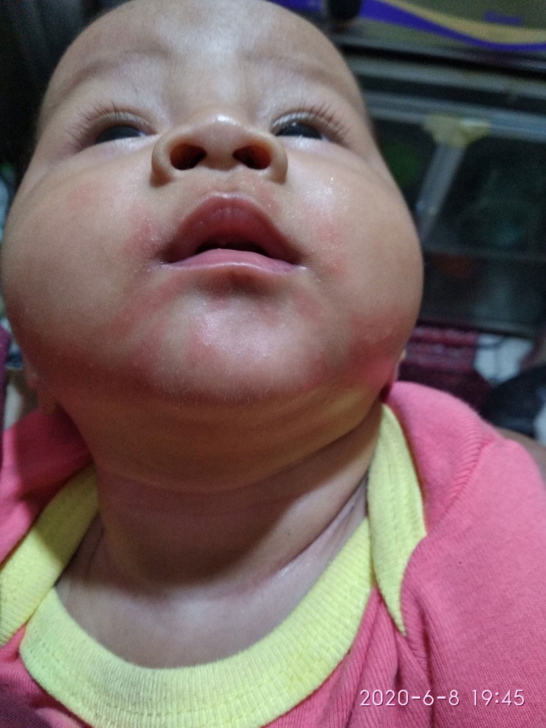 reaksi bayiku 4 bulan minum sufor