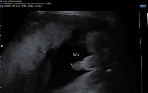 Baby Boy is coming