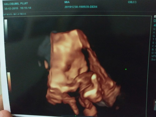 34week ??