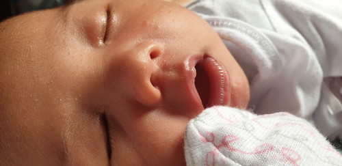 pano mawala ang butlig sa muka ng newborn