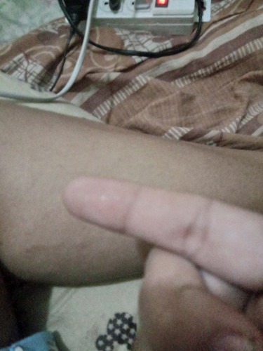 มีนํ้าออกจากทางช่องคลอดนํ้าไสๆแต่ออกไม่มากมันคืดอะไรหรอค่ะ