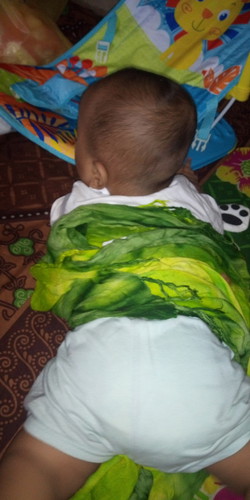 Rambut anak sedikit
