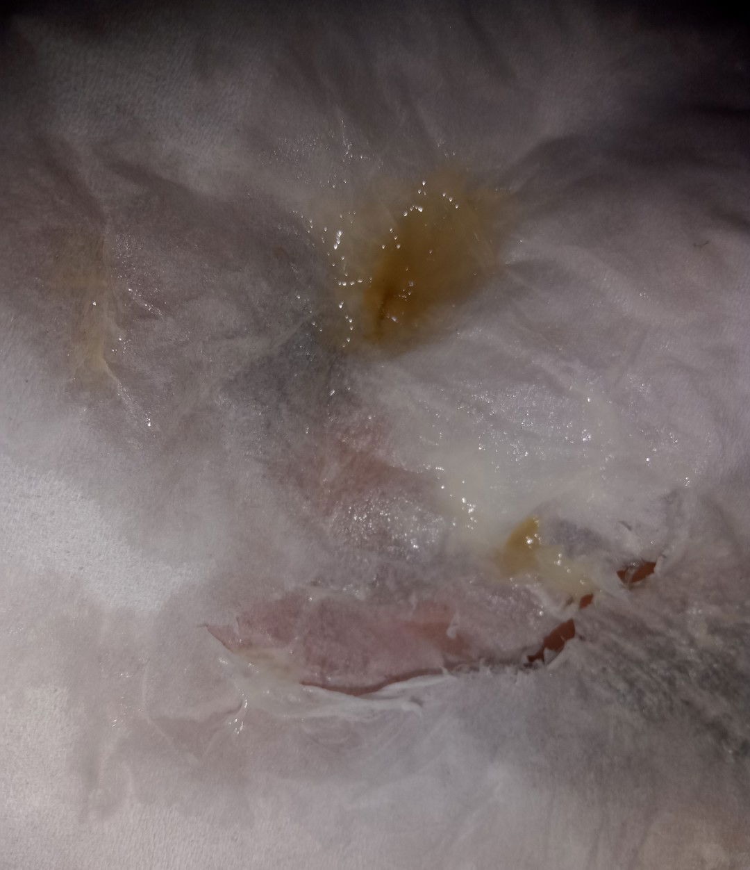 Tanda2 kehamilan atau termasuk keputihan juga