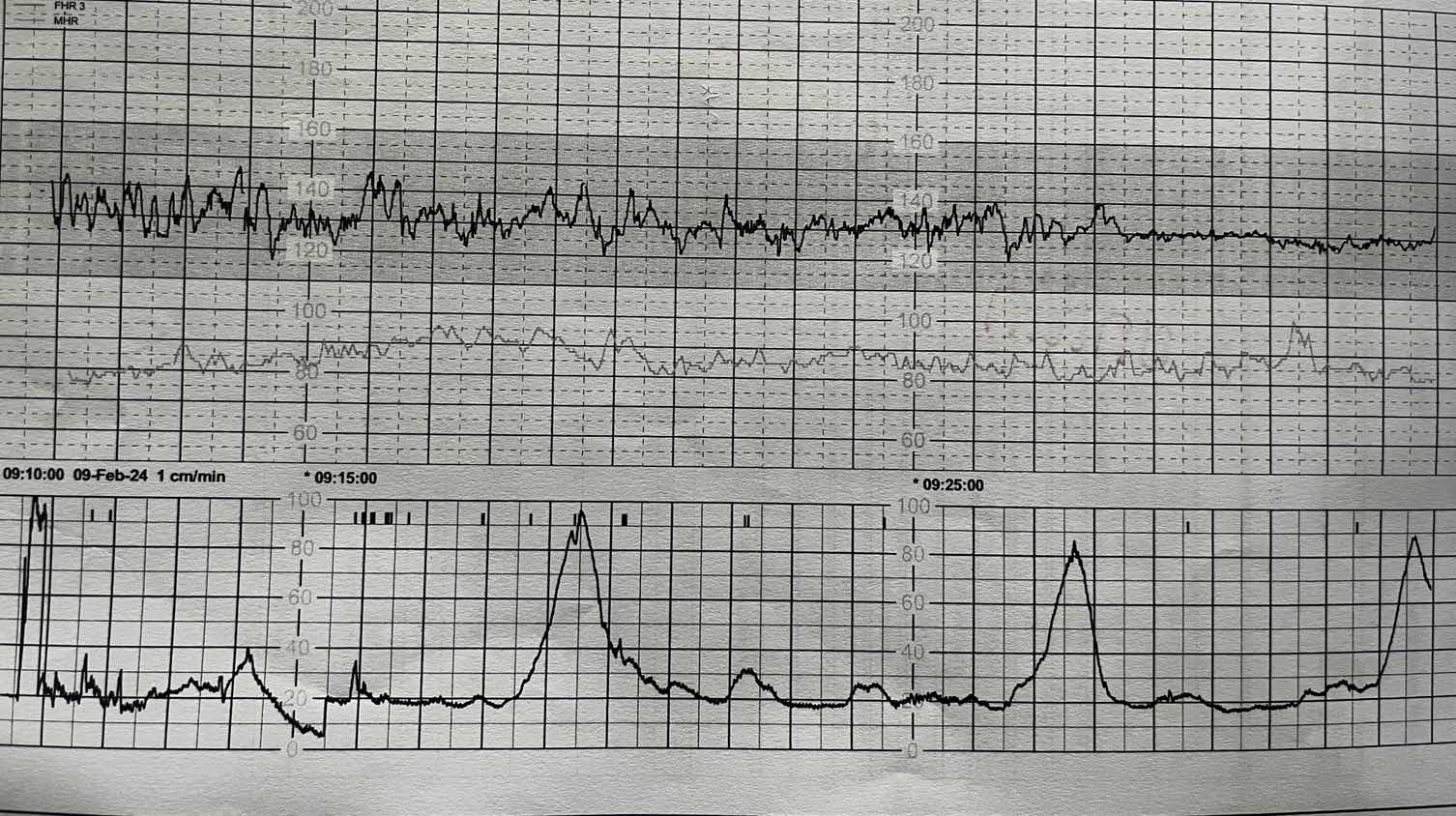 สอบถามแม่ๆค่ะ