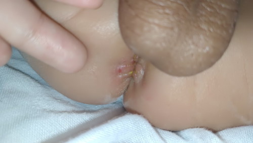 ลูกเป็นแผลปากรูทวารรักษายังไงค่ะ