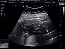 Noppron Teesan profile icon