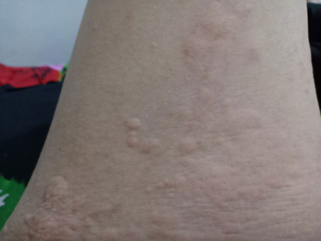 BIDURAN setelah 6bln Melahirkan