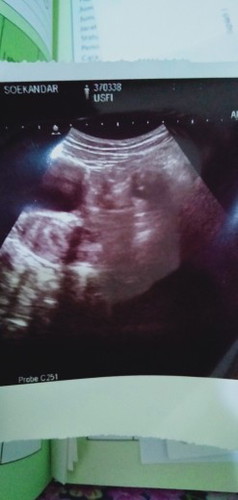 hamil 4 Minggu 3hari