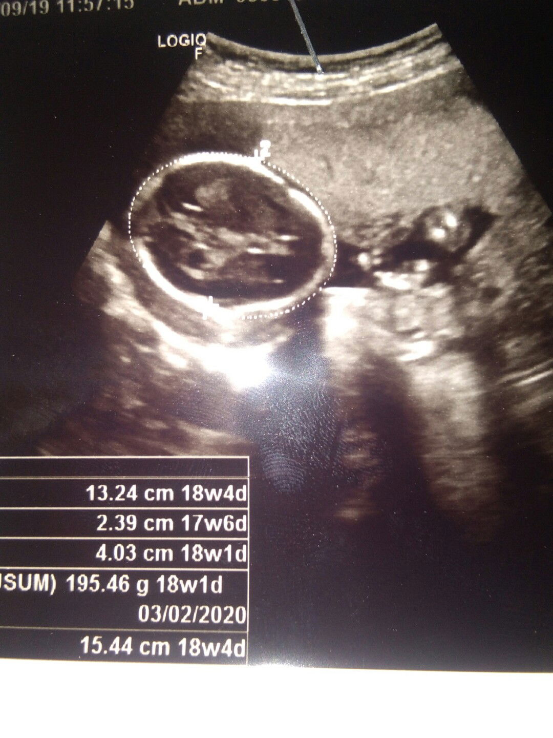 ตั้งครรภ์