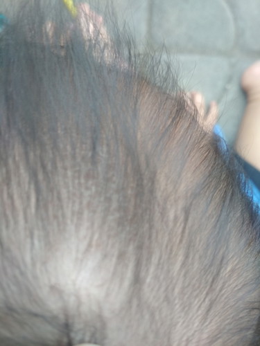 kepala bayi