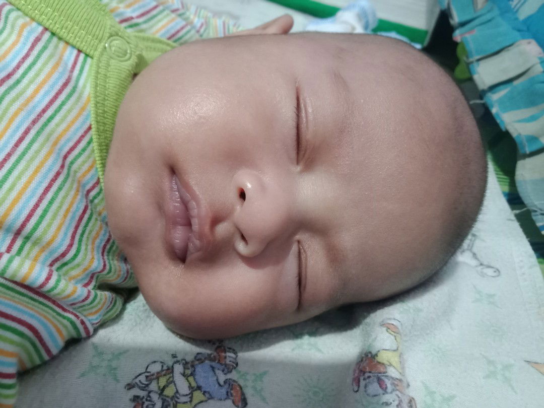 bekas asi jadi kaya panu