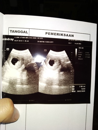 hasil usg