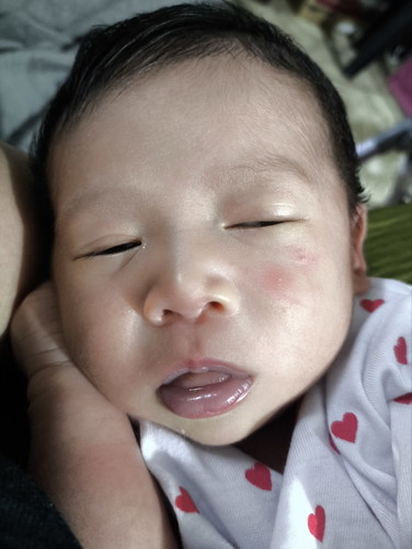 Maitim po ba lips ng baby ko or normal naman?