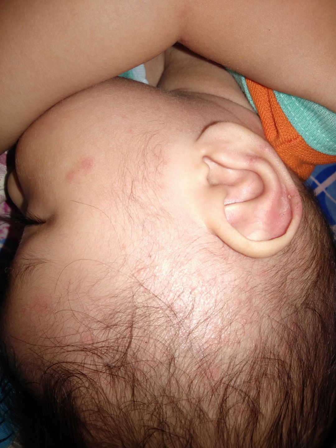 salep ampuh bintik merah