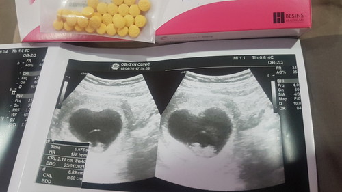 วันนี้หมอนัด