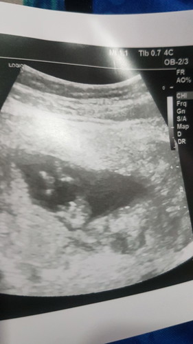 12w