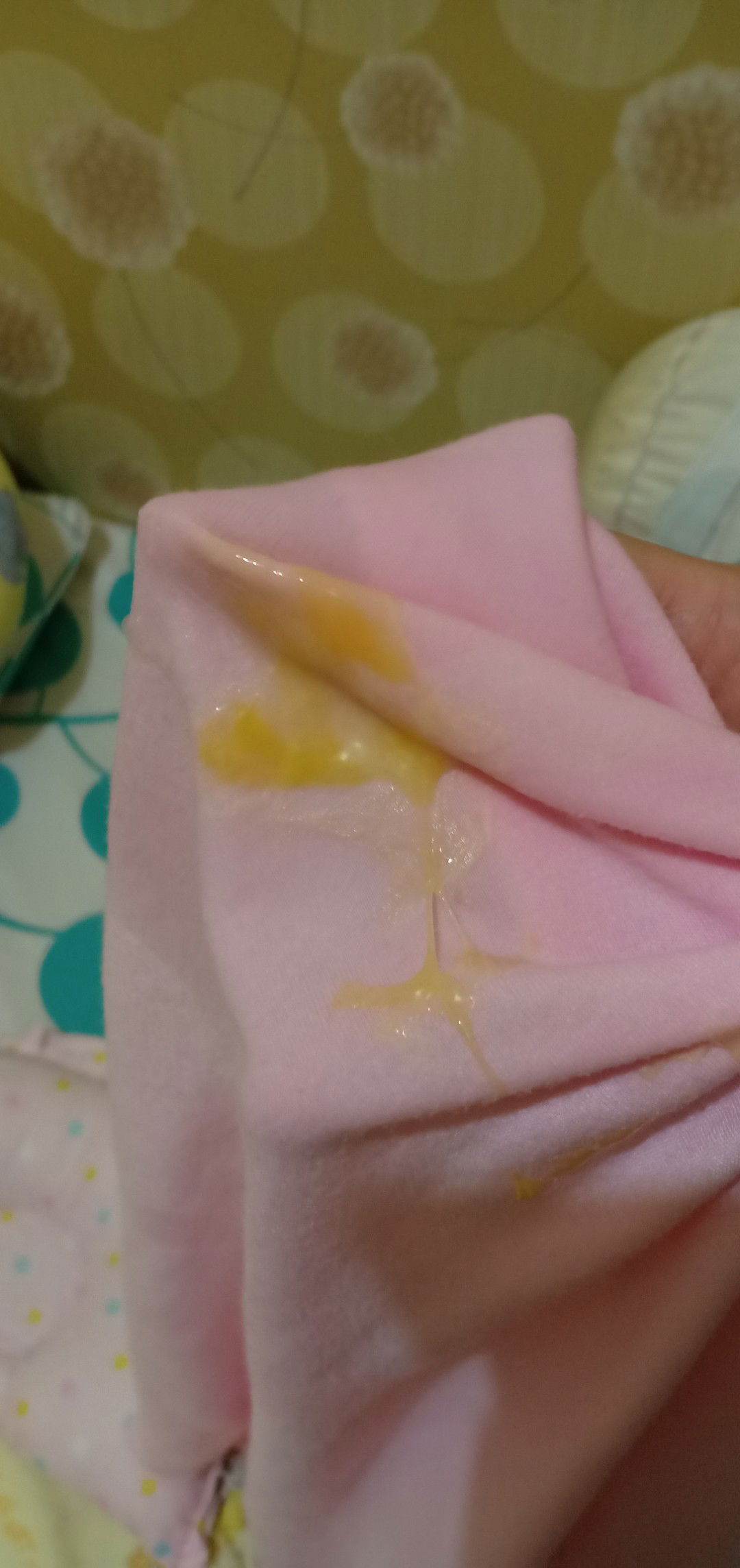 Muntah bayi ada lendir kuning