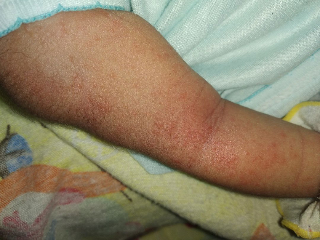 badan berbintik merah