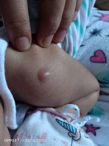 ano po ba itong lumilitaw sa braso ni baby