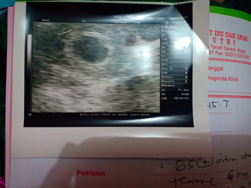 6w4d