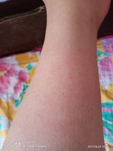 worried pls advice