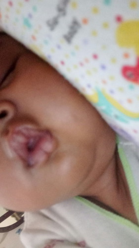 Sharing yuk bunda perawatan untuk Bayi PJB