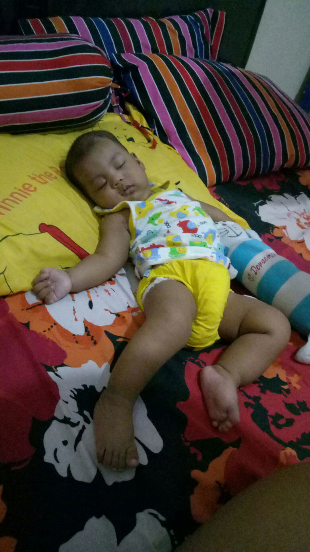 usia berapa bayi belajar tengkurap ?