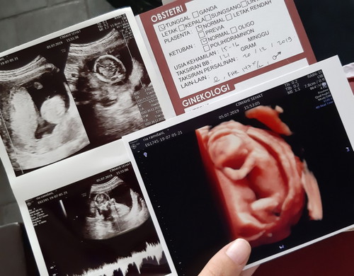 mau liat jenis kelamin baik nya weeks brp ya