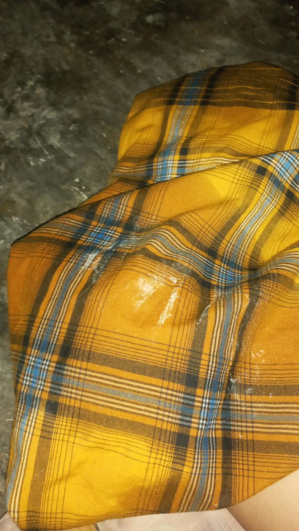 Keluar Cairan Disamping Banyak