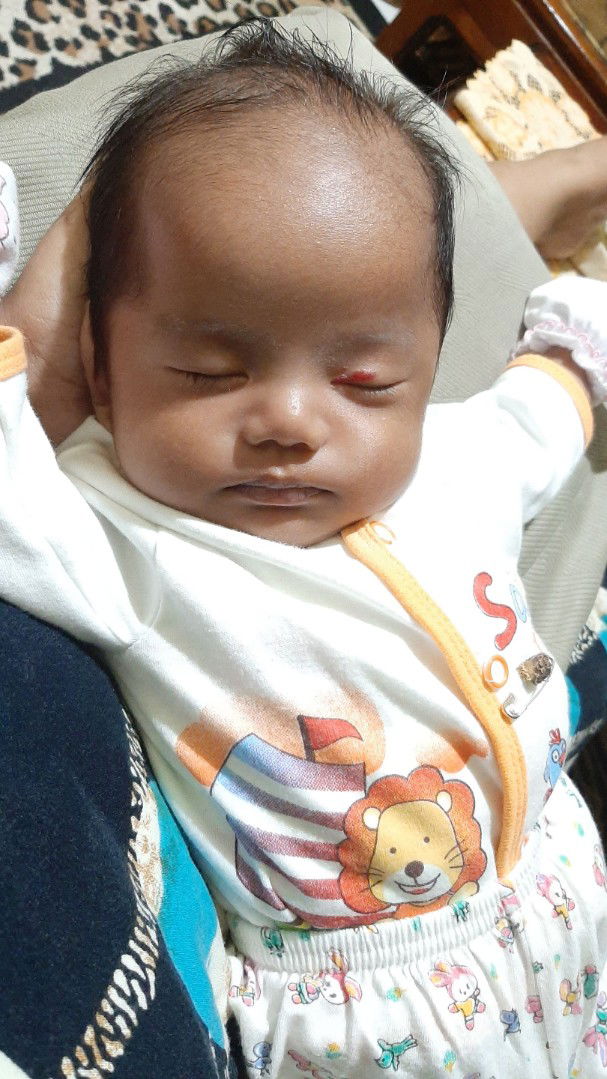 galau gara2 tanda lahir kiss angel