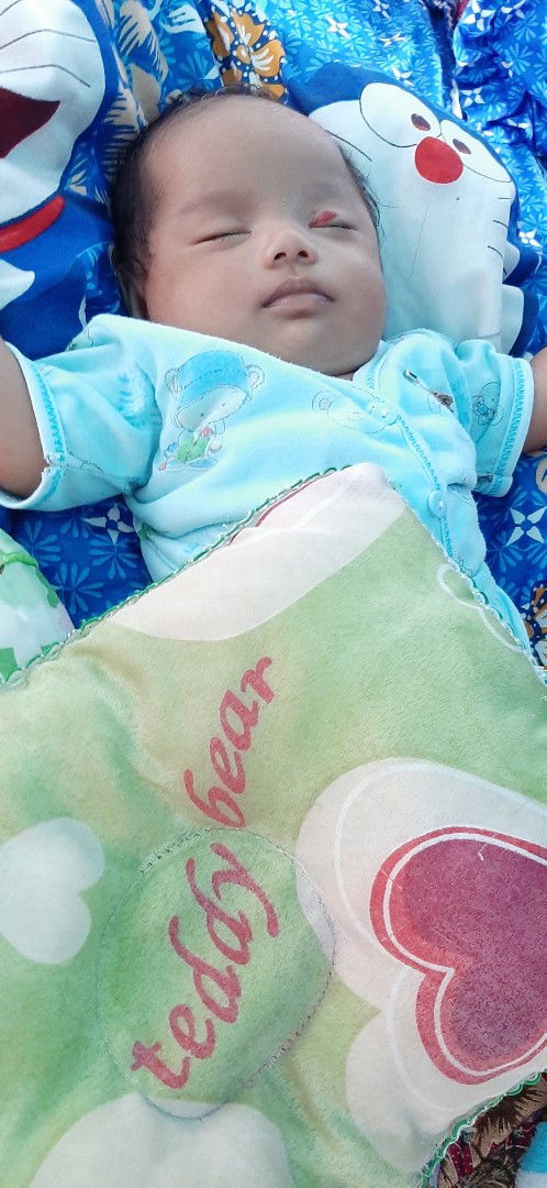 sedih lihat kelopak mata anak merah