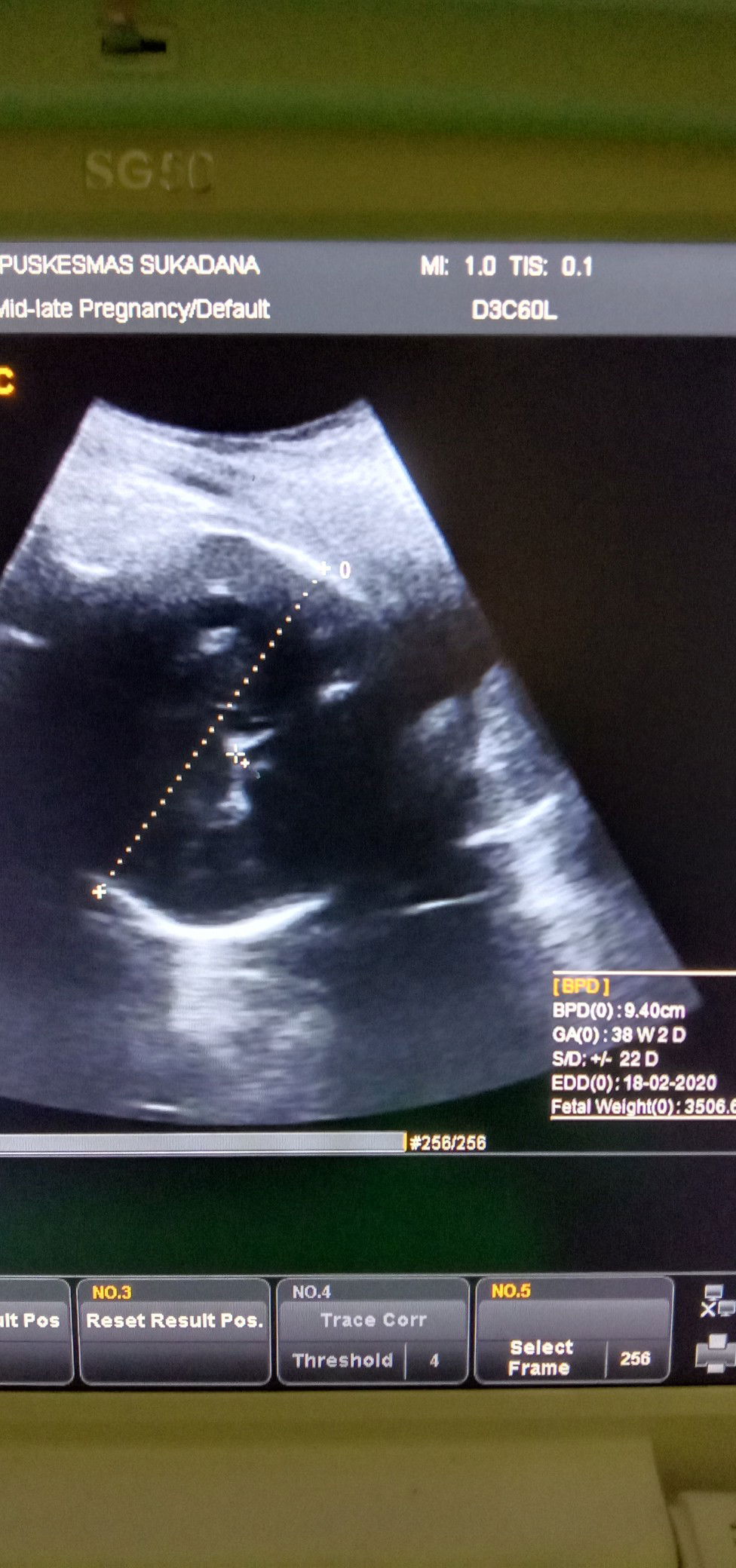 BBJ berlebih di uk 37w