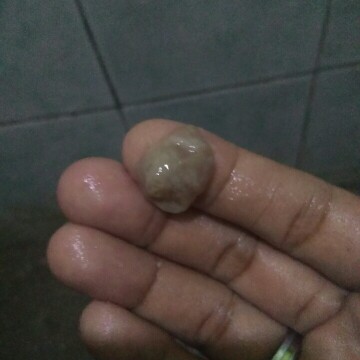 mucus plug????