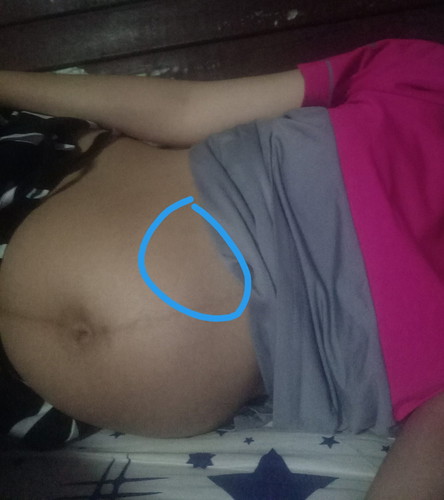 ปวดท้อง